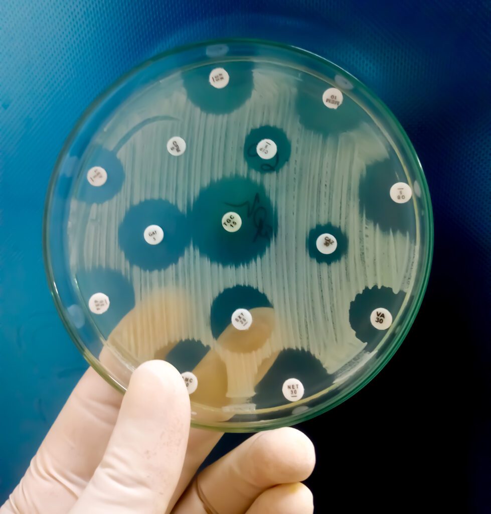 Proteon Brasil publica segundo Artigo em parceria com Quiron Comunicação sobre diferentes classes de Antimicrobianos